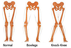 body capacity, leg diagram